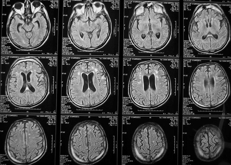 МРТ снимок мозга в Нахабино