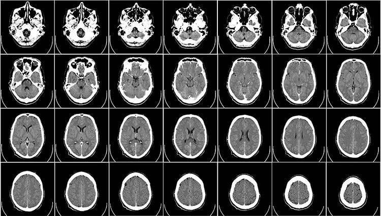 Снимок МРТ мозга в Красногорске