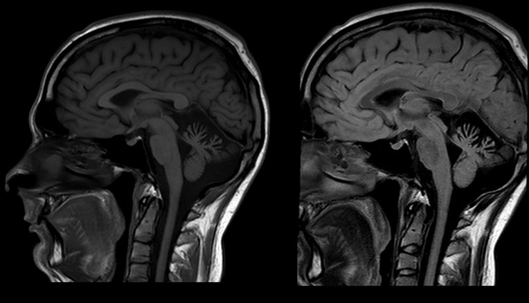 Снимок МРТ головы недорого