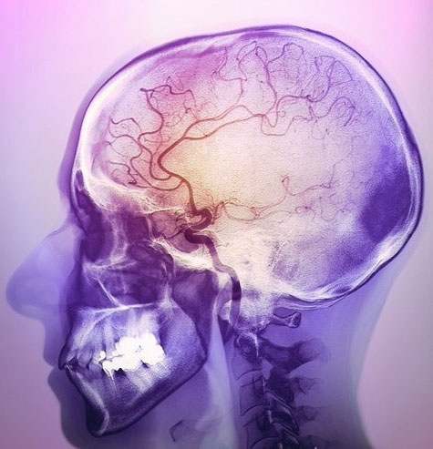 МРТ сосудов головного мозга в Москве