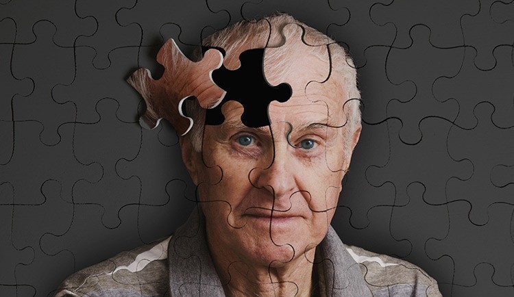 Особенности заболевания Альцгеймера