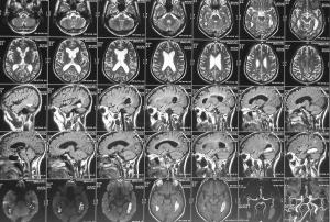 Снимок головы МРТ в Тушино