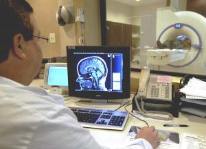 Проведение МРТ головы при шизофрении