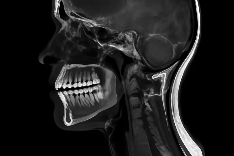 Снимок МРТ челюсти